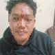 Kondisi wajah guru SDN 017 Balikpapan Timur yang diduga menjadi korban pengeroyokan usai menegur siswa merokok berseragam.