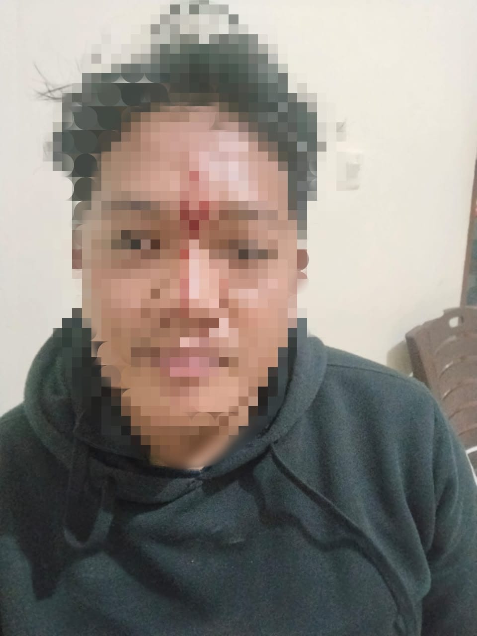 Kondisi wajah guru SDN 017 Balikpapan Timur yang diduga menjadi korban pengeroyokan usai menegur siswa merokok berseragam.